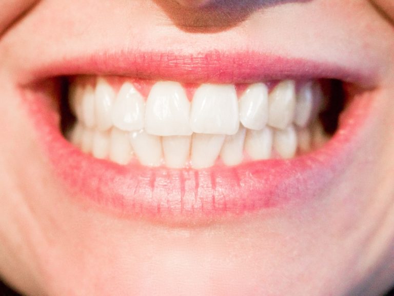Dzisiejsza technologia używana w salonach stomatologii estetycznej być może sprawić, że odzyskamy śliczny uśmiech.